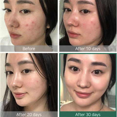 SOMEBYMI AHA BHA PHA 30 Days Miracle Toner Best Korean Beauty Skincare at Nudie Glow in Australia